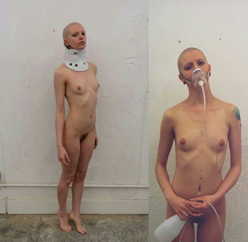 Slave girl bald » WWII